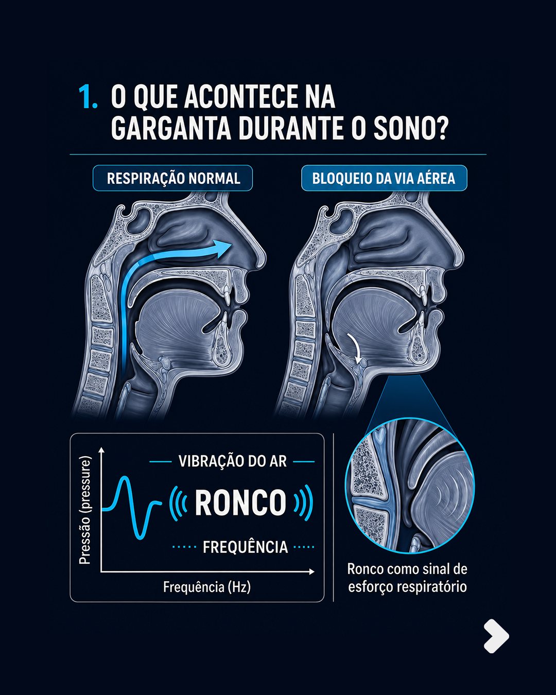 O ronco prejudica o seu coração!